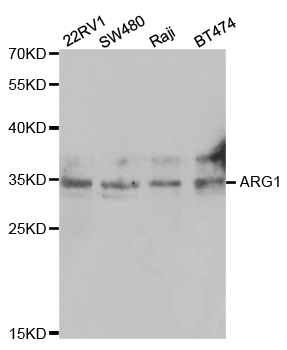 Anti-ARG1 Antibody