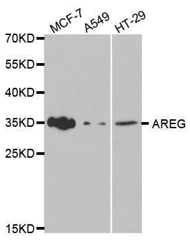 Anti-AREG Antibody