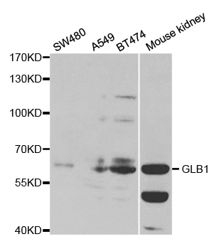 Anti-GLB1 Antibody