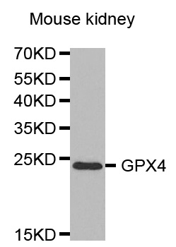 Anti-GPX4 Antibody