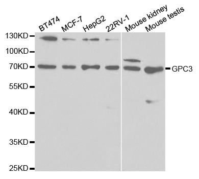 Anti-GPC3 Antibody