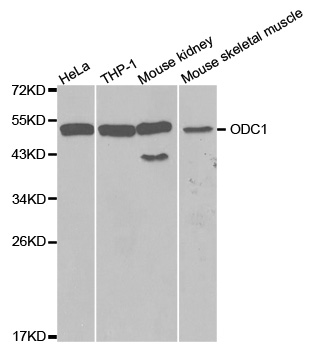 Anti-ODC1 Antibody