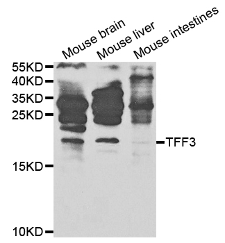 Anti-TFF3 Antibody