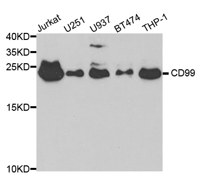 Anti-CD99 Antibody