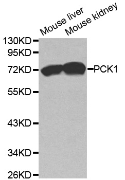 Anti-PCK1 Antibody