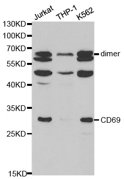 Anti-CD69 Antibody