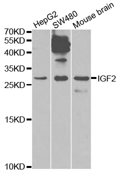 Anti-IGF2 Antibody