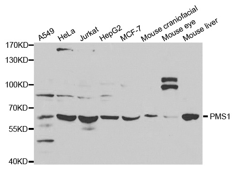 Anti-PMS1 Antibody