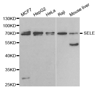 Anti-SELE Antibody