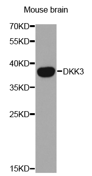 Anti-DKK3 Antibody