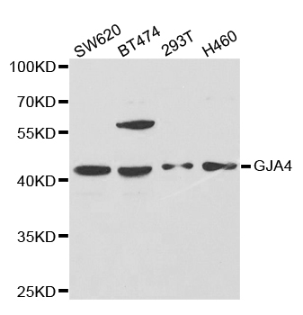 Anti-GJA4 Antibody