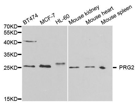 Anti-PRG2 Antibody