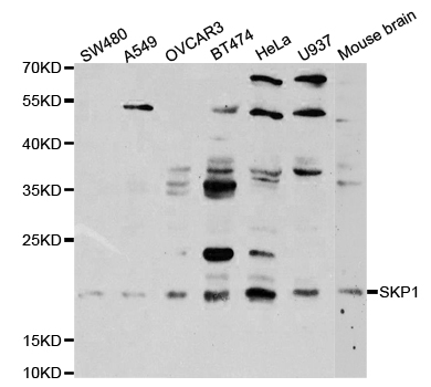 Anti-SKP1 Antibody