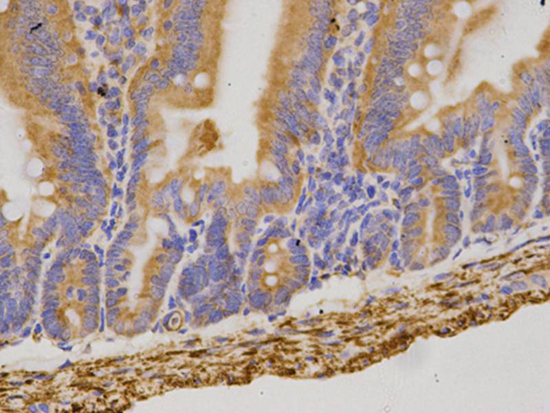 Anti-CD19 Antibody Anti-CD19 Antibody
