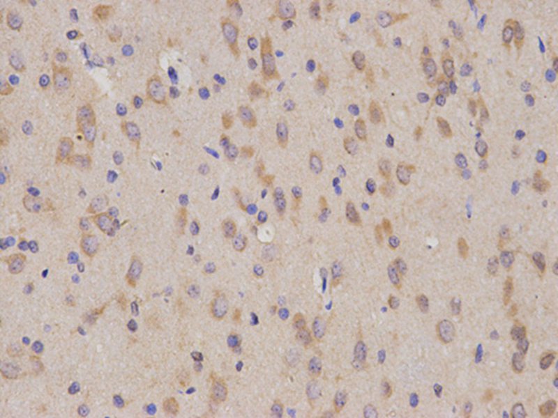 Anti-CD19 Antibody Anti-CD19 Antibody