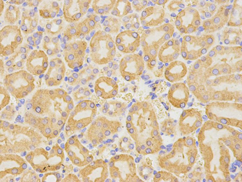 Anti-CD19 Antibody Anti-CD19 Antibody