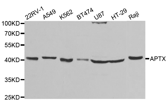 Anti-APTX Antibody