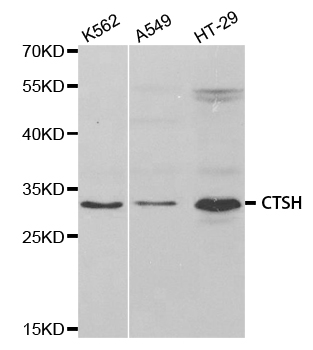 Anti-CTSH Antibody