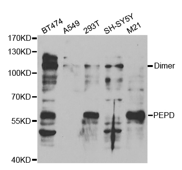 Anti-PEPD Antibody