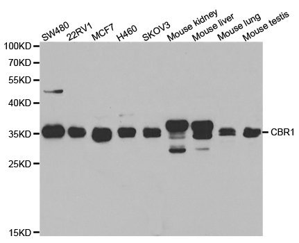 Anti-CBR1 Antibody