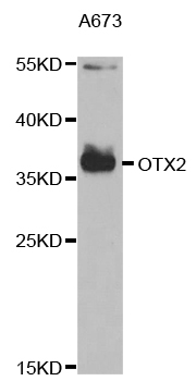 Anti-OTX2 Antibody