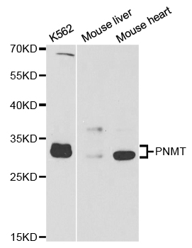 Anti-PNMT Antibody