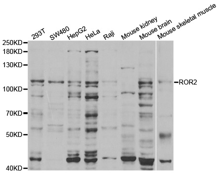 Anti-ROR2 Antibody
