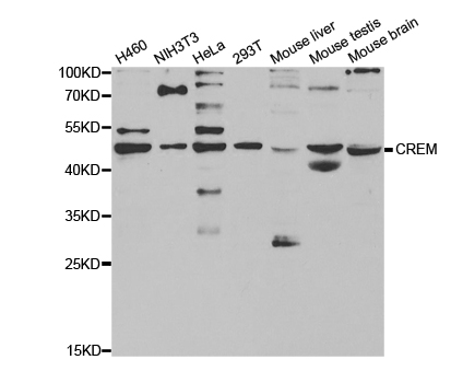 Anti-CREM Antibody
