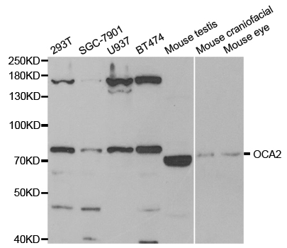 Anti-OCA2 Antibody