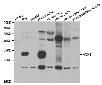 Anti-AQP4 Antibody