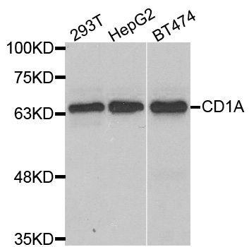 Anti-CD1A Antibody