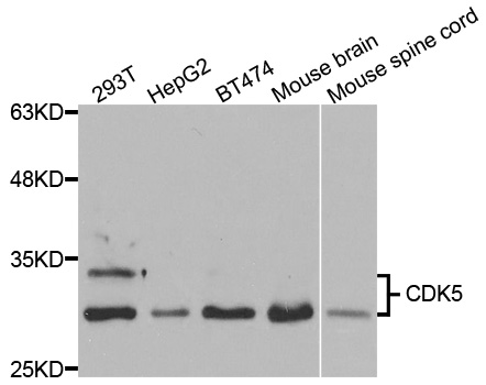 Anti-CDK5 Antibody