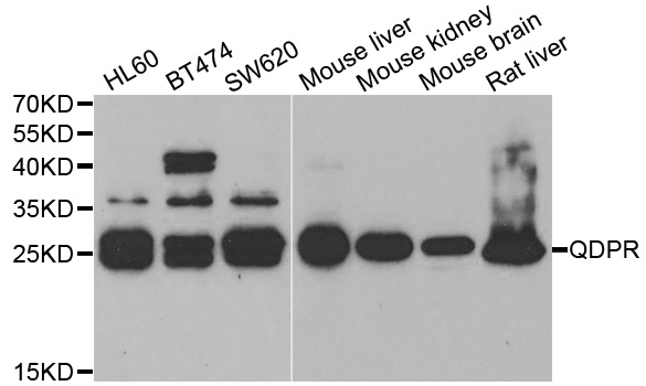 Anti-QDPR Antibody