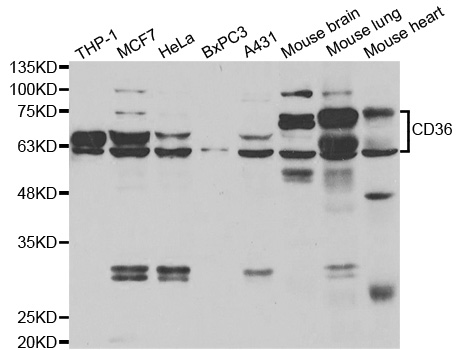 Anti-CD36 Antibody