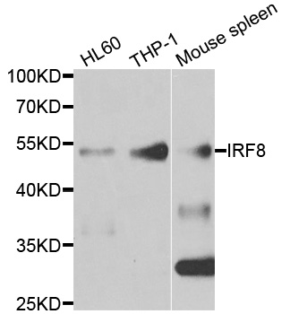 Anti-IRF8 Antibody