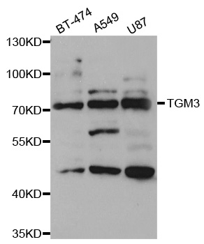 Anti-TGM3 Antibody