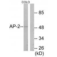Anti-AP-2 Antibody