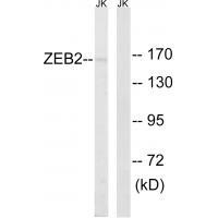 Anti-ZEB2 Antibody