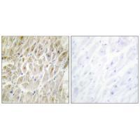 Anti-DLX3 Antibody Anti-DLX3 Antibody