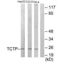 Anti-TCTP Antibody