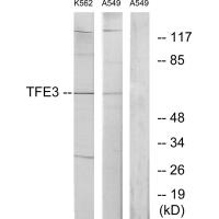 Anti-TFE3 Antibody