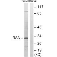 Anti-RPS3 Antibody