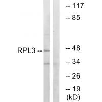 Anti-RPL3 Antibody