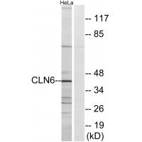 Anti-CLN6 Antibody