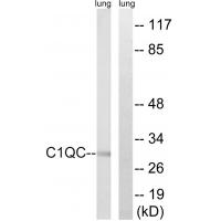 Anti-C1QC Antibody