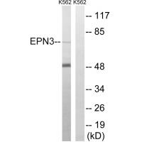 Anti-EPN3 Antibody