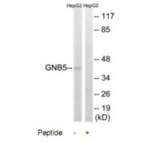 Anti-GNB5 Antibody