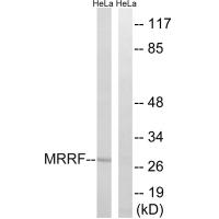 Anti-MRRF Antibody