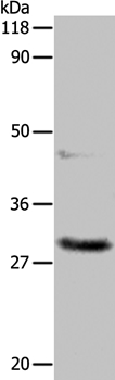 Anti-APIP Antibody