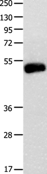Anti-BMP4 Antibody